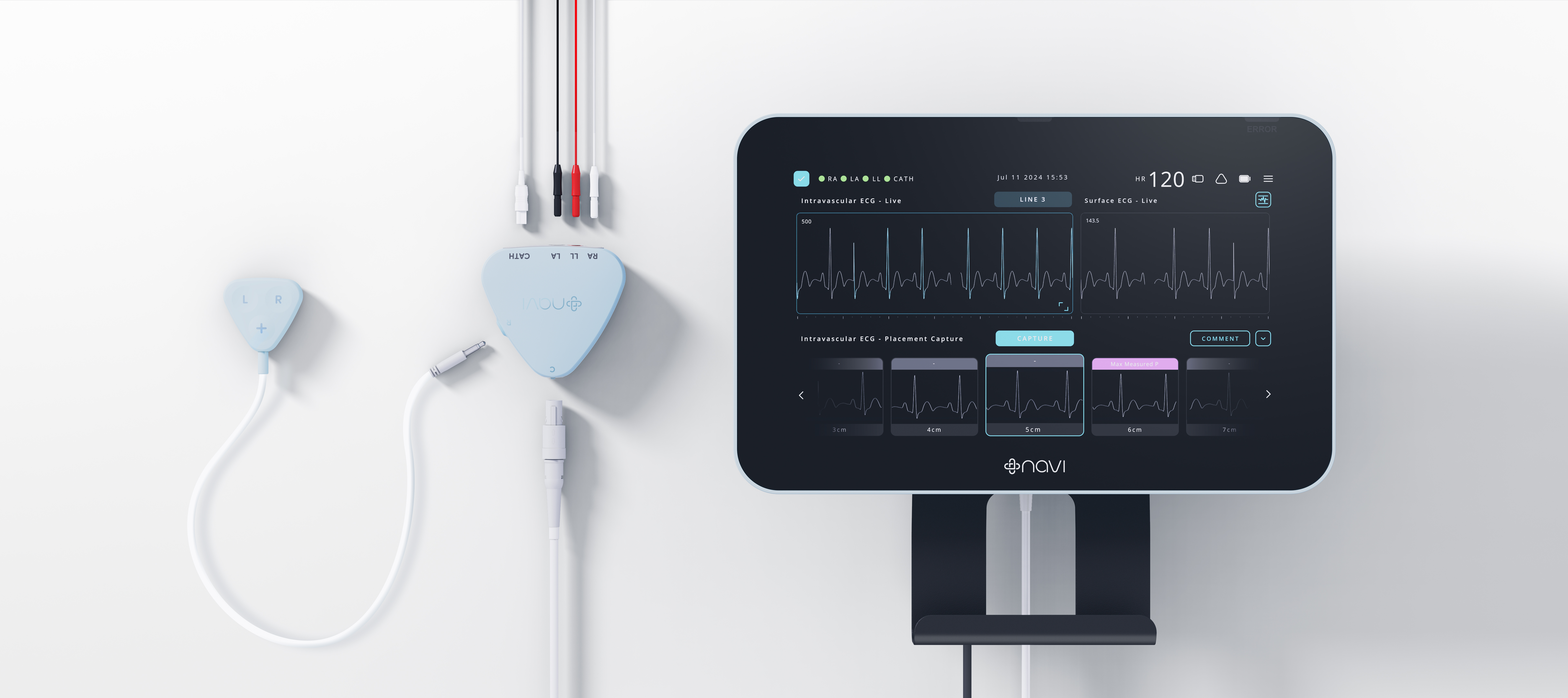 NeoNav ECG Tip Location System