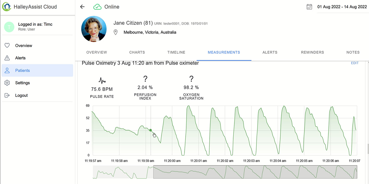 HalleyAssist pulse oximetry data delivered to dashboard